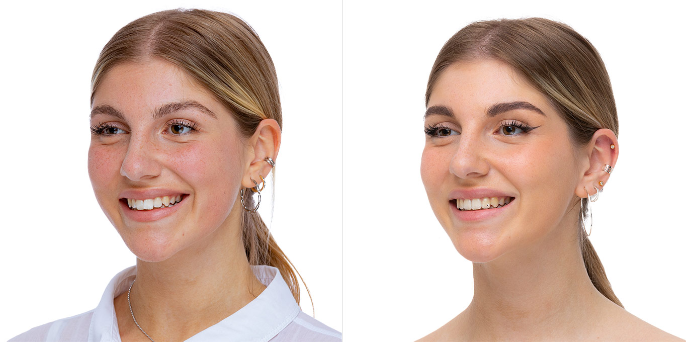 erwachsene-vorher-nachher-1